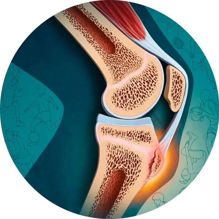 D'Struktur vum Gelenk an Ëmgéigend Stoffer