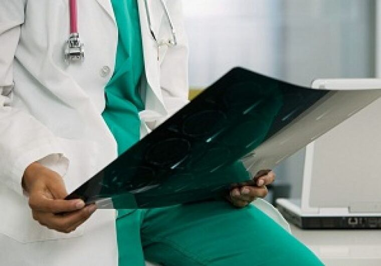 Röntgen hëlleft dem Dokter ze diagnostizéieren Osteochondrose vun der thoracic Wirbelsäule
