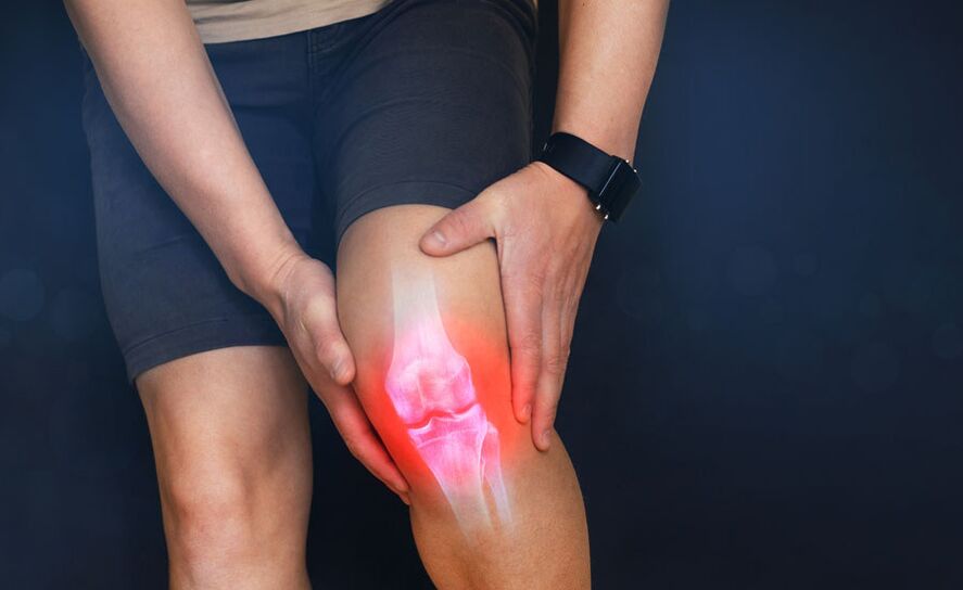 Gefor vu Konsequenze vun Arthrosis