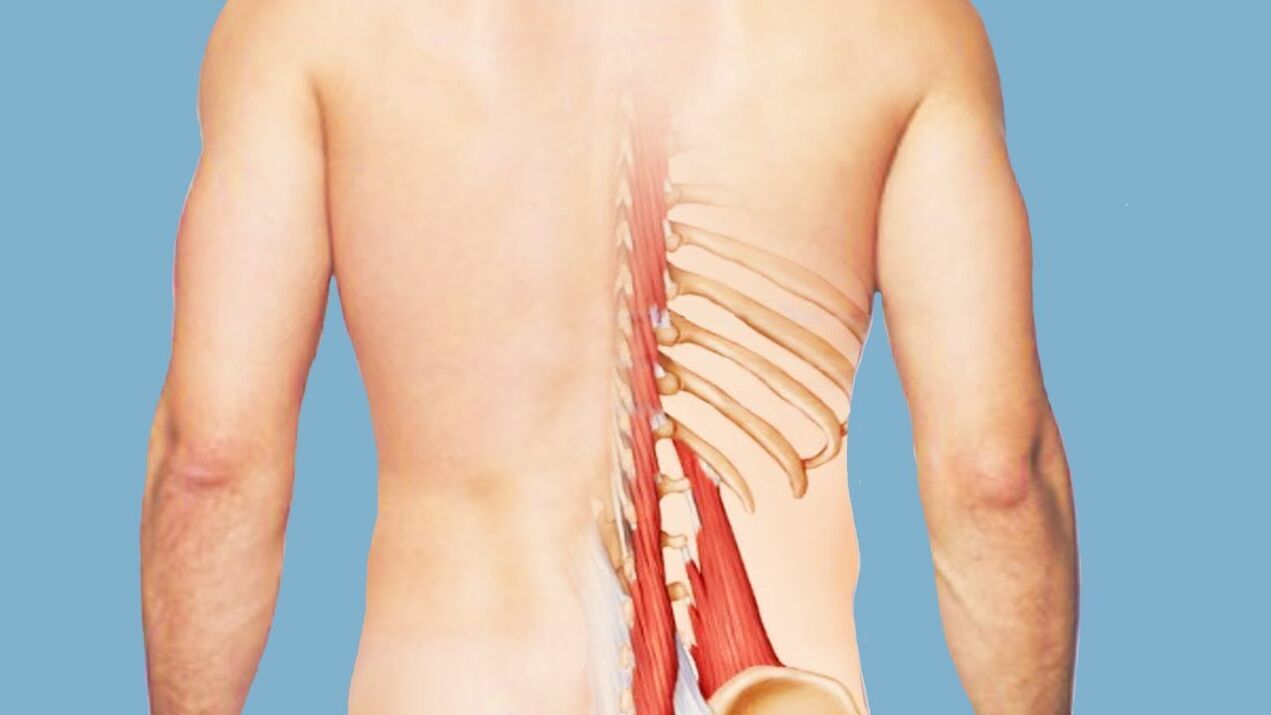 myositis als Ursaach vun niddereg zréck Péng