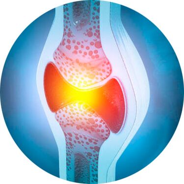 gemeinsame Restauratiounsprozess mat Icexin Gel